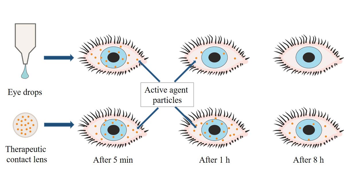fig-enhancement-bioavailability-ocl