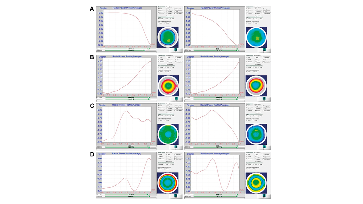 Radial power profiles of the iLens